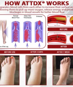 ATTDX® Advanced CVI Edema Therapy Cream