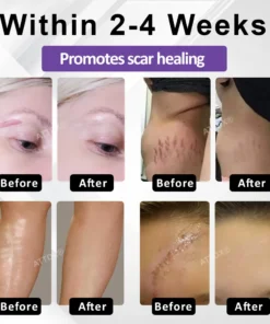 ATTDX® ClearScar Advanced Therapy Spray