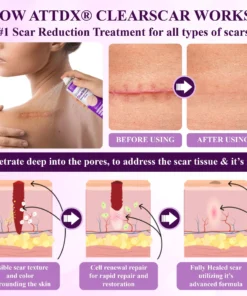 ATTDX® ClearScar Advanced Therapy Spray
