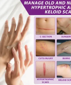 ATTDX® ClearScar Advanced Therapy Spray