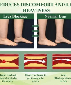 ATTDX® FluidEase Leg Therapy Edema Cream