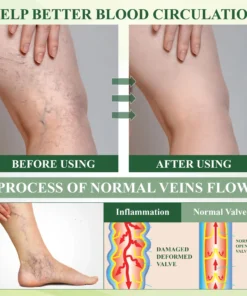 ATTDX® FluidEase Leg Therapy Edema Cream