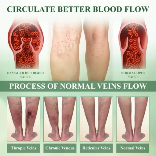 ATTDX® FluidEase Leg Therapy Edema Cream