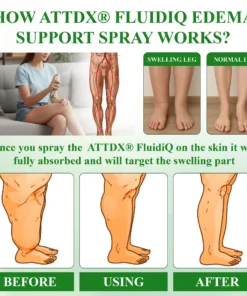 ATTDX® FluidiQ Edema Support Spray