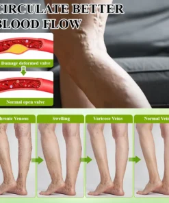 ATTDX® FluidiQ Edema Support Spray