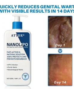 ATTDX® NanoLipo HPV Genital Warts Eraser Cream