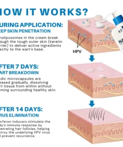 ATTDX® NanoLipo HPV Genital Warts Eraser Cream
