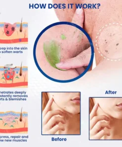 ATTDX® NatureErase Instant Alligator Oil Mole & Spot Cream