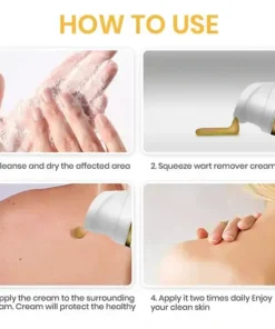 ATTDX® NatureStore Instant Mole & Spot Cream