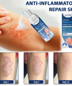 ATTDX® PsoriEase Magnesium Healing Foam