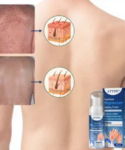 ATTDX® PsoriEase Magnesium Healing Foam