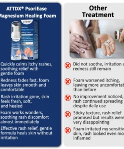 ATTDX® PsoriEase Magnesium Healing Foam