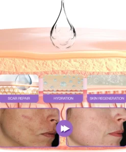 ATTDX® RevivaDerma Face & Body Scar Gel