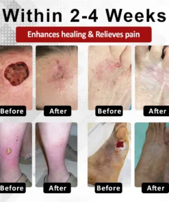 ATTDX® DiabeHeal Magnesium Recovery Capsules