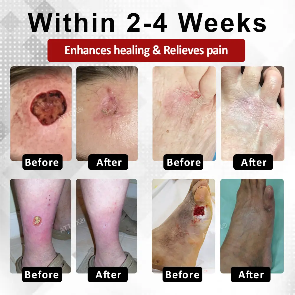 ATTDX® DiabeHeal Magnesium Recovery Capsules