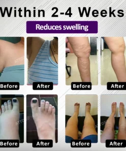 ATTDX® Edemora Overnight Balance Spray