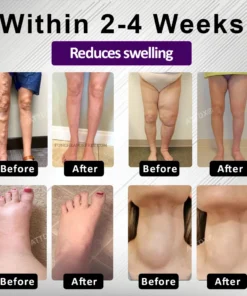 ATTDX® Edemora Overnight Balance Spray