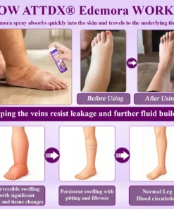 ATTDX® Edemora Overnight Balance Spray