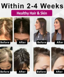 ATTDX® ThickHer Hair VitaGrowth Capsules