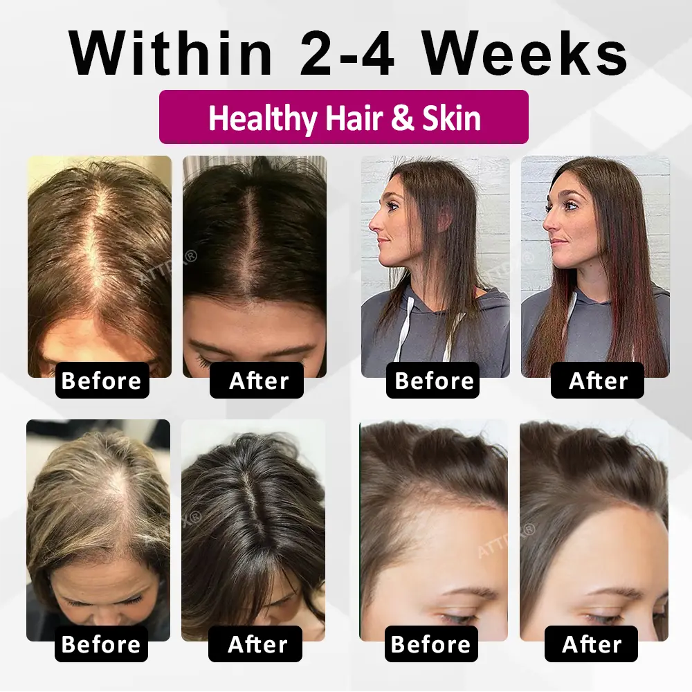 ATTDX® ThickHer Hair VitaGrowth Capsules