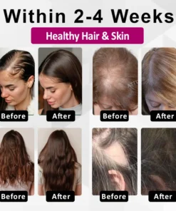 ATTDX® ThickHer Hair VitaGrowth Capsules