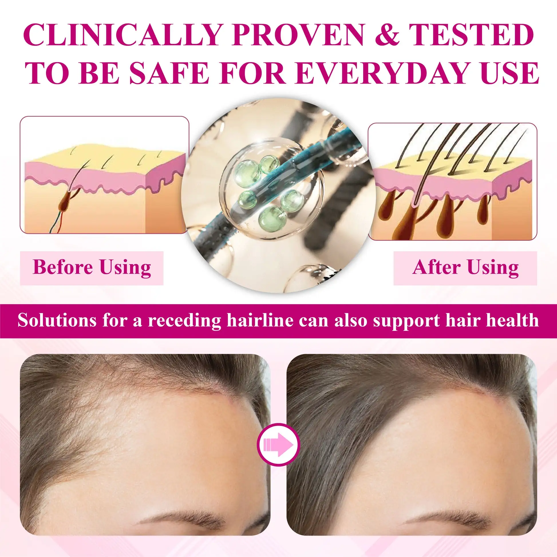 ATTDX® ThickHer Hair VitaGrowth Capsules