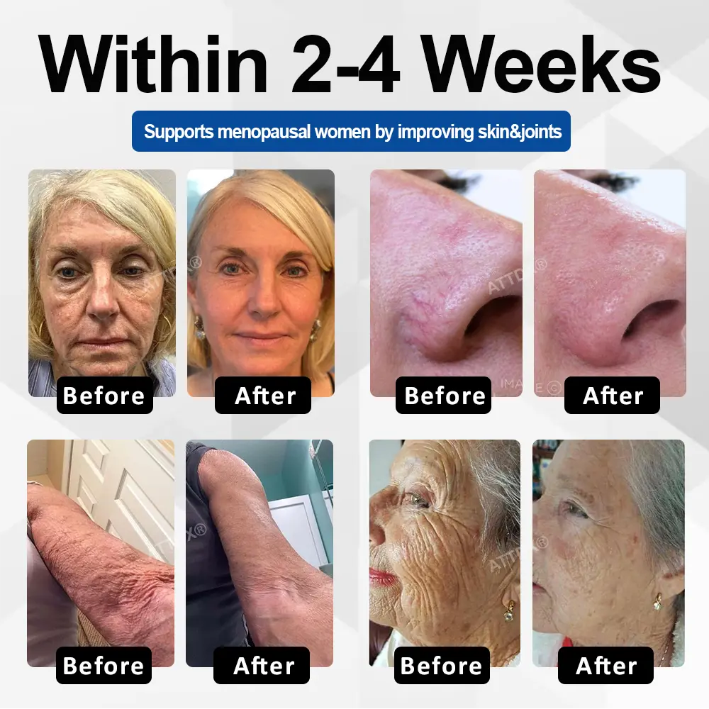 ATTDX® CollaRenew Complex Inner Rebuild Capsules