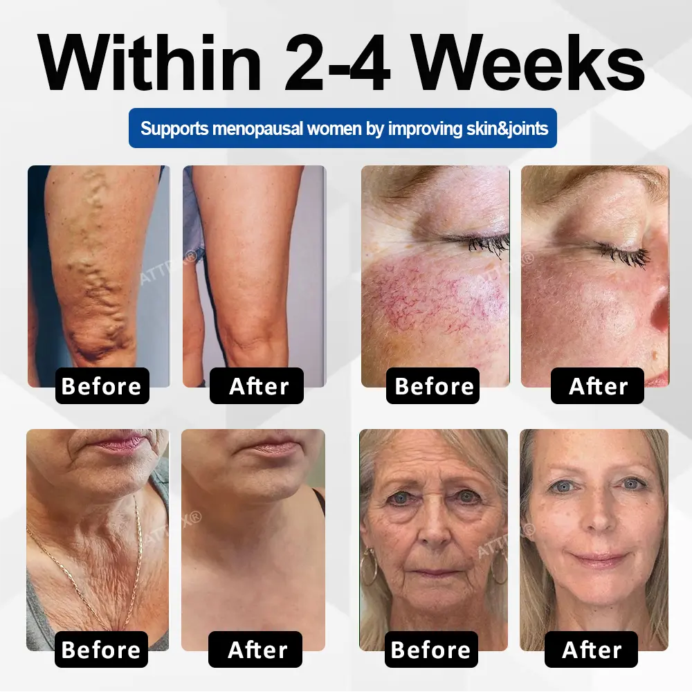 ATTDX® CollaRenew Complex Inner Rebuild Capsules