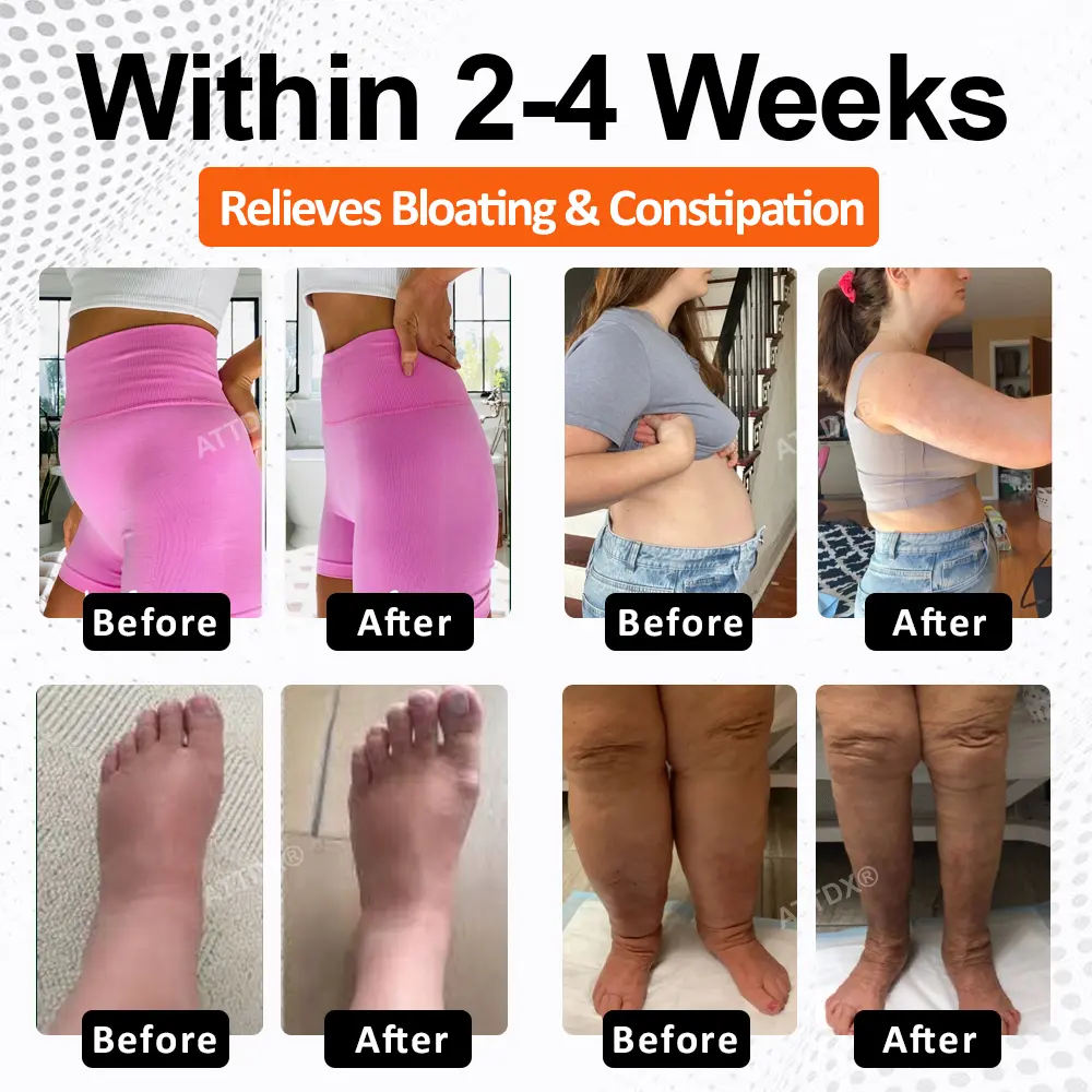 ATTDX® GutLight TripleMag Bloating Relief Capsules