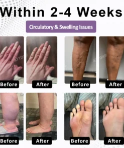 ATTDX® MenoVasc Collagen Flow Restoration Capsules