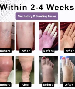 ATTDX® MenoVasc Collagen Flow Restoration Capsules