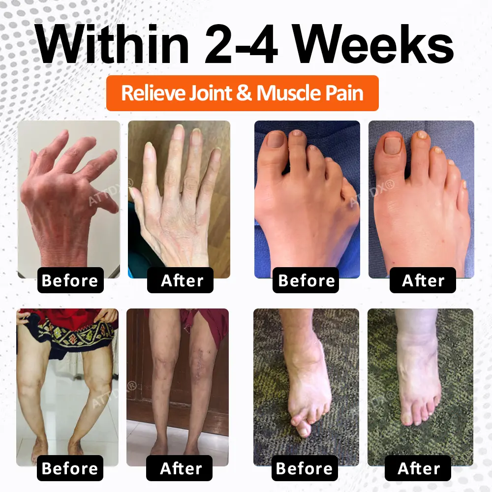 ATTDX® Mobility Max Magnesium Complex Softgels