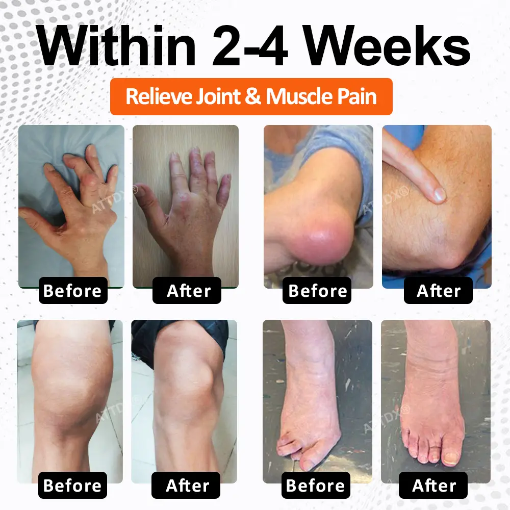 ATTDX® Mobility Max Magnesium Complex Softgels