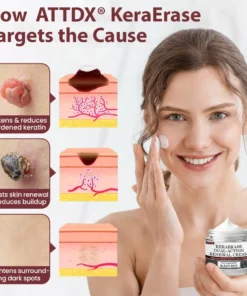 ATTDX® KeraErase Dual-Action Renewal Cream