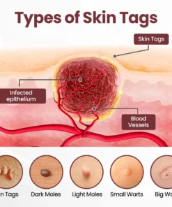 ATTDX® KeraErase Dual-Action Renewal Cream