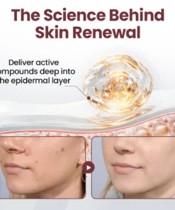 ATTDX® KeraErase Dual-Action Renewal Cream