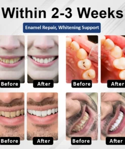 ATTDX® BioEnamel Biomimetic Tooth Armor Drops