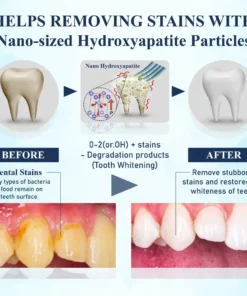 ATTDX® BioEnamel Biomimetic Tooth Armor Drops
